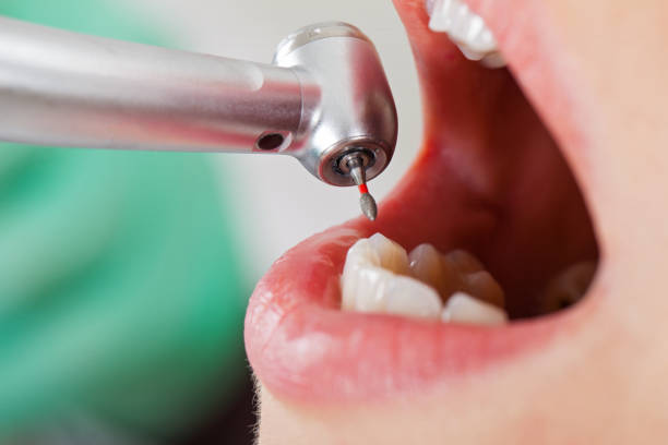 Best Emergency Treatment for Jaw Pain or Injury in Compo, CT